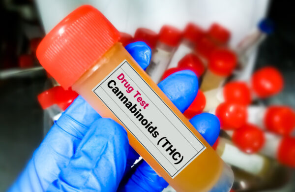 Urine sample for Cannabinoid (THC) drug test.